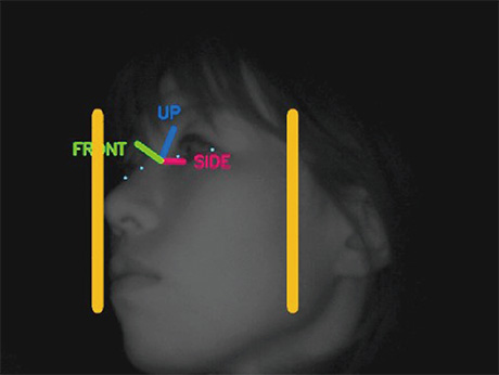 Fig. 6 Side face detection results (Permission to use the image was confirmed based on a letter of consent)