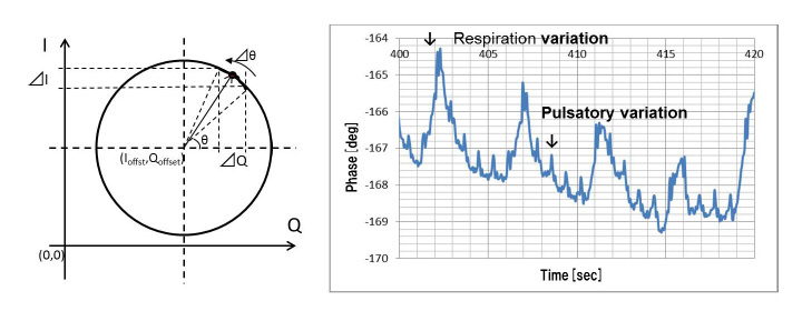 Figure 3 Observation of body surface with I-Q Lissajous waveform