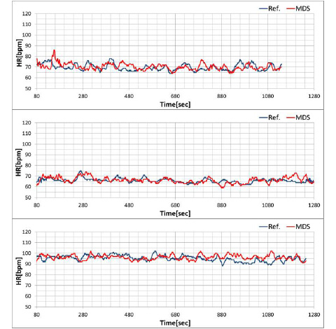 Figure 14 Estimate accuracy of pulse rate while driving in a city