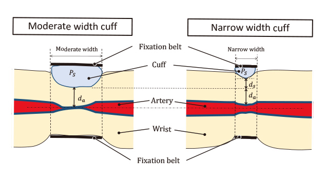 Fig. 2 Influence of the cuff width on the intra-cuff pressure