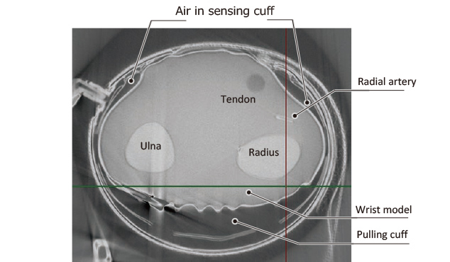 Fig. 13 Cross-sectional view of the tension-type sensing cuff