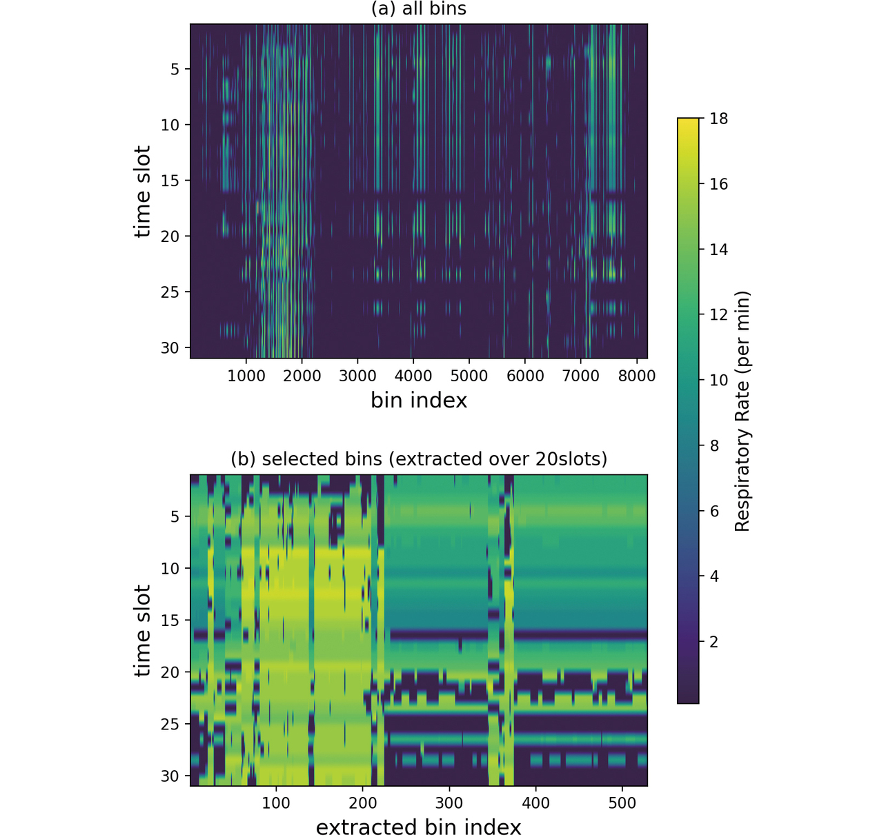 Fig. 9 Extracted respiratory rate窶冱 time trend map