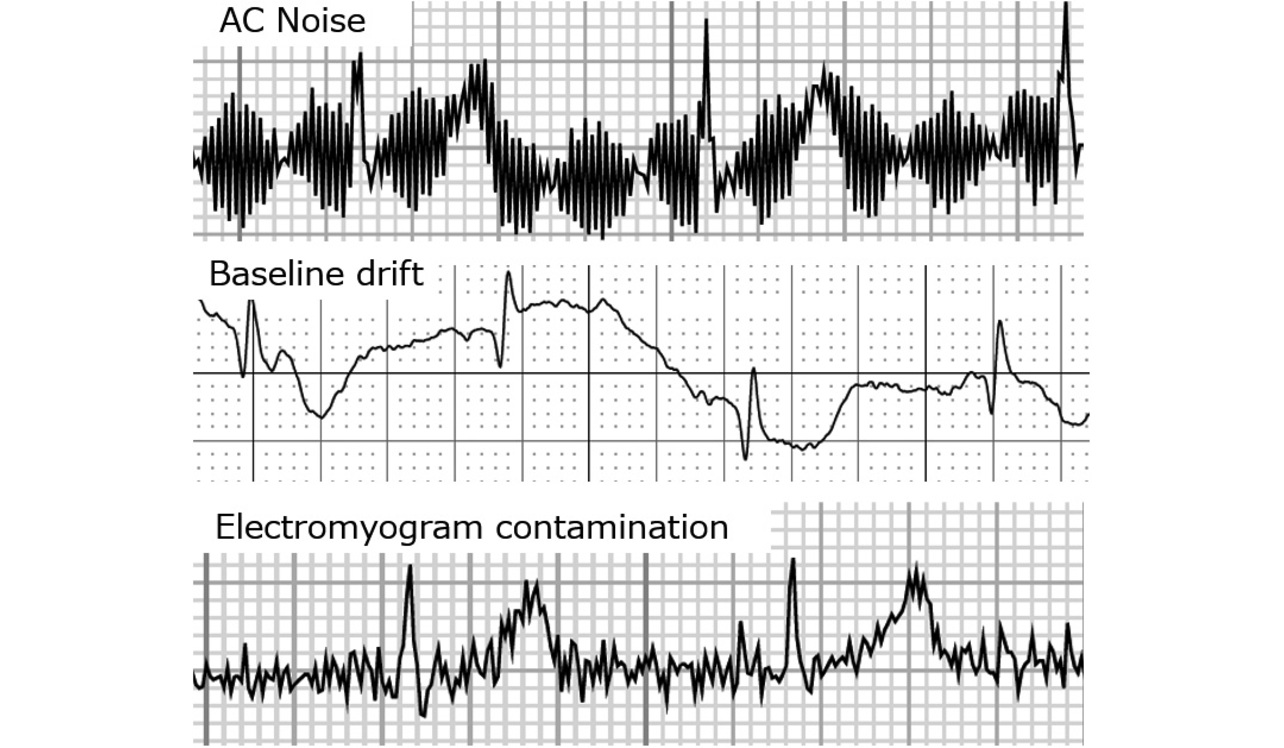 Fig. 2 Noise waveforms