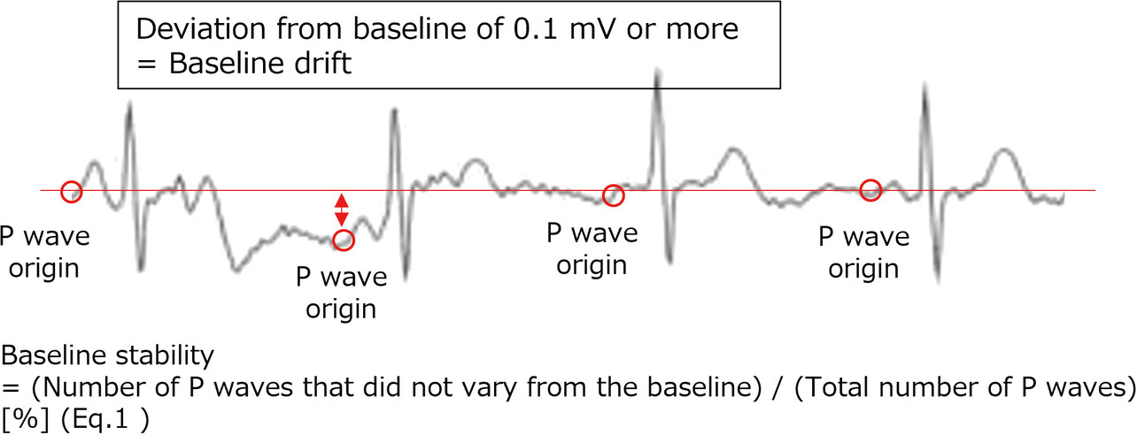 Fig. 6 Baseline drift judgment