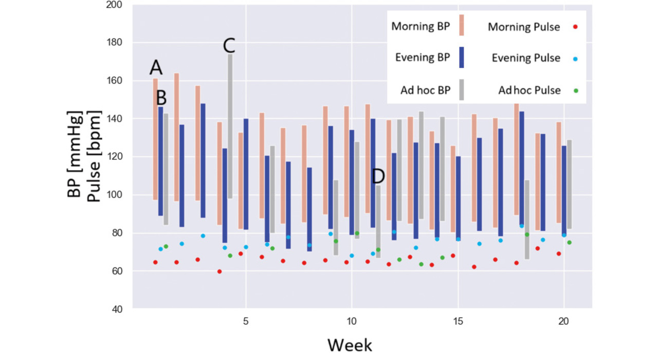 Fig. 10 Typical BP graphing (1)
