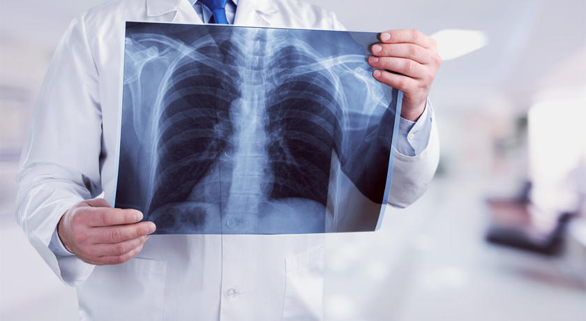 Improving on the job safety for radiologists