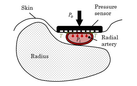 図1 トノメトリ法の概要