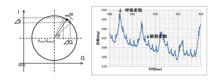 図3 I-Qリサージュ波形と身体表面の観察