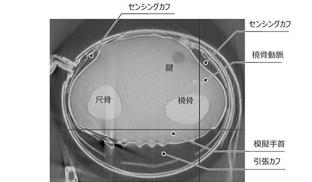 図13　引張方式のセンシングカフの様子