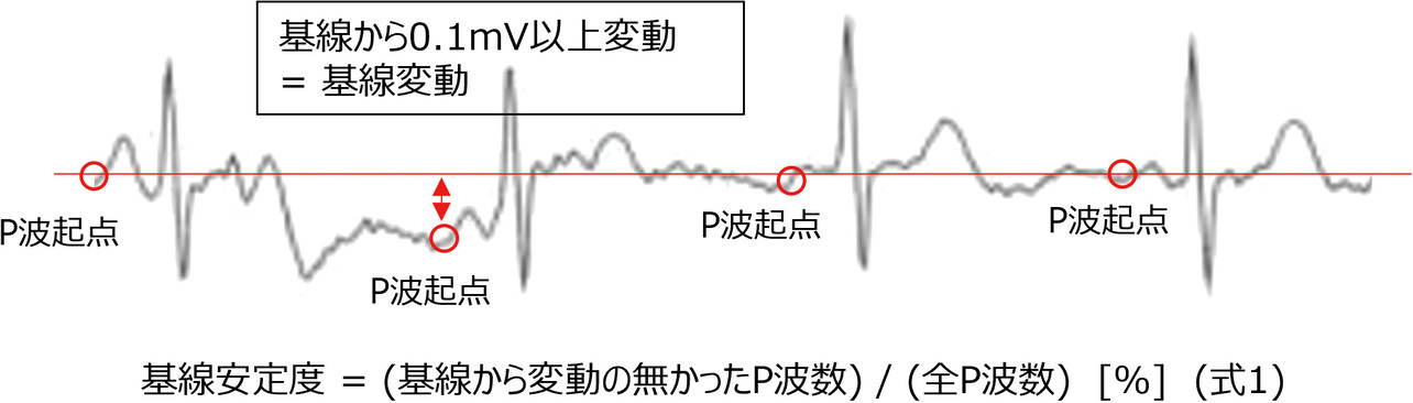 図6 基線変動判定