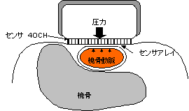 トノメトリ法