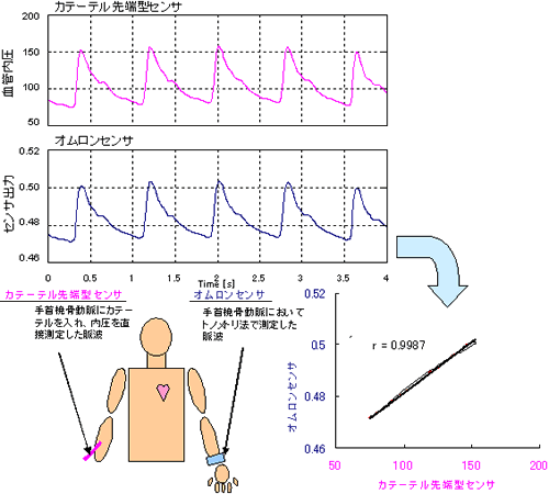 手首直接法と手首トノメトリ法の脈波形の比較