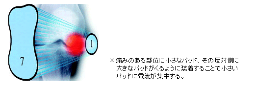 大きさの異なるパッドで、患部を集中治療