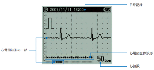 自覚症状があるとき等の心電図が簡単に記録できる携帯心電計 携帯心電計