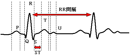 心電図の波形
