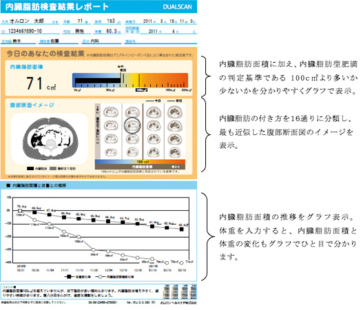 内臓脂肪検査結果レポート