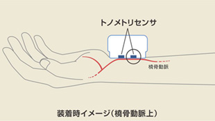 装着イメージ（橈骨動脈上）